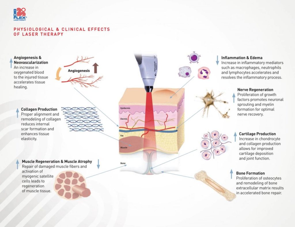 Elements Massage Therapy - Bioflex Laser Therapy& Spa